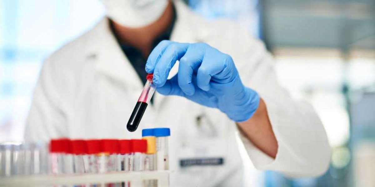 Global Haemato Oncology Testing Market Size Share Key Players Demand Growth Analysis Research Report