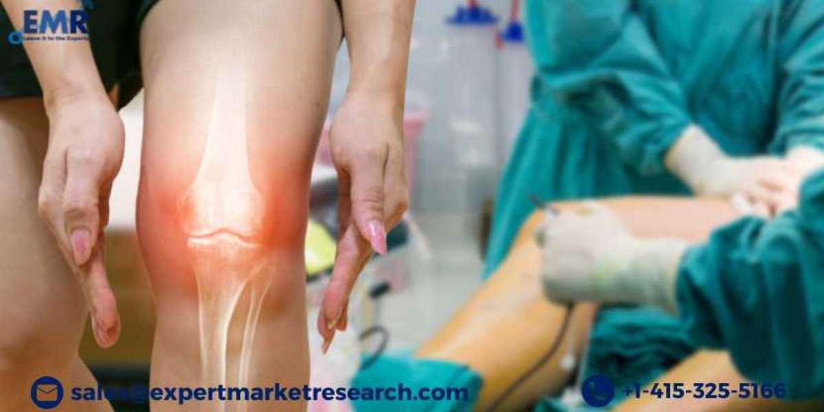 Global Knee Cartilage Repair Market Size Share Key Players Demand Growth Analysis Research Report