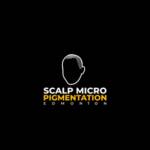 Scalp Micro Pigmentation Edmonton