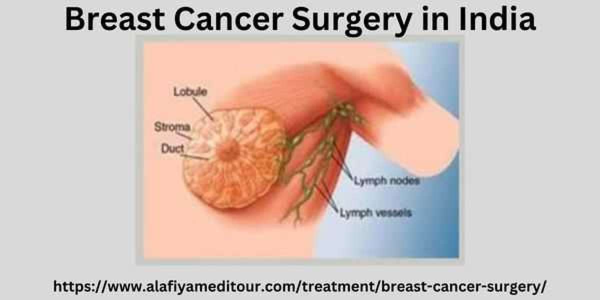 Breast Cancer Surgery in India: Affordable and Effective Treatment Option