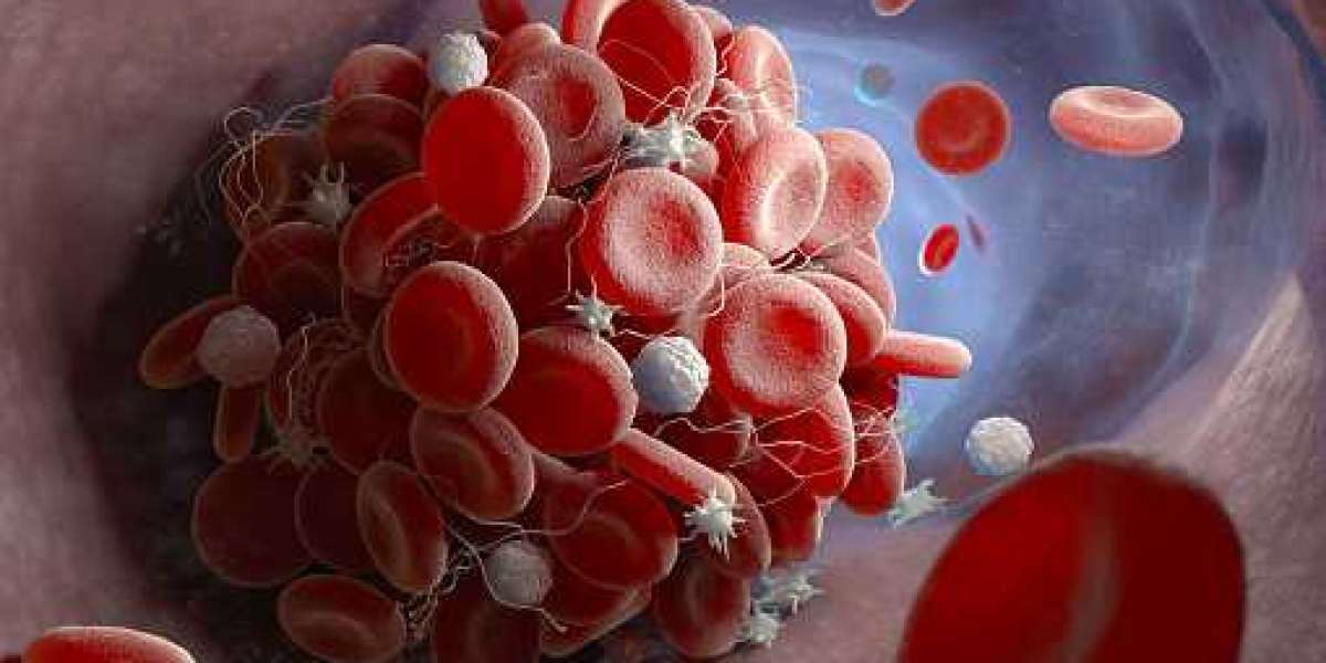 Hematology Diagnostics Market Growth Analysis 2021