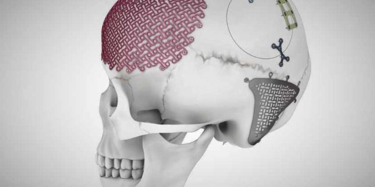 Global Craniomaxillofacial Implants Market Share, Size, Growth, Trends & Forecast | 2024 - 2032