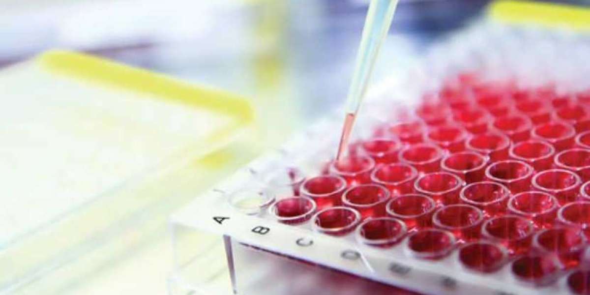 Global Cell-based Assays Market Share, Size, Trends, Outlook, Growth, Segments & Forecast | 2024 - 2032